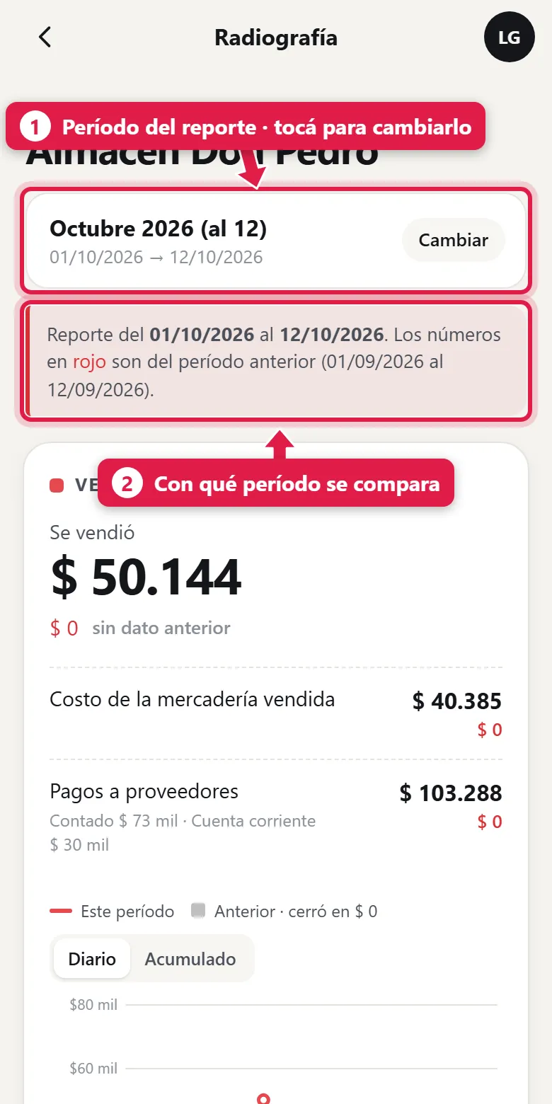 Radiografía